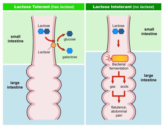 lactose-intolerance_med esquema intolerancia lactosa intestino